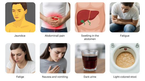 découvrez les 7 signes révélateurs d'un foie malade qui peuvent nuire à votre santé. apprenez à reconnaître ces symptômes précurseurs pour agir rapidement et préserver le bon fonctionnement de votre foie.